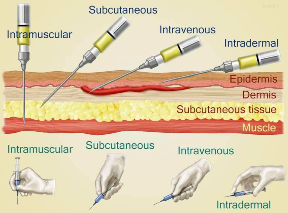 subcutaneous injection technique